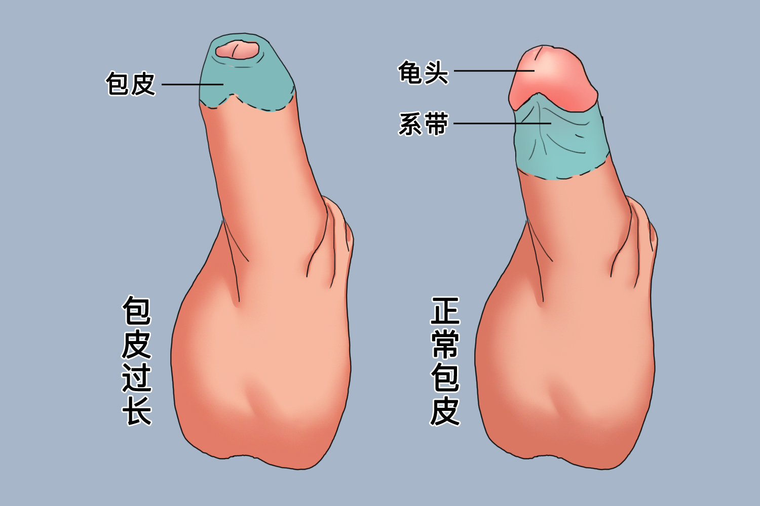 探索男性生理奧秘，包皮的正常形態(tài)解析，男性生理奧秘探索，包皮正常形態(tài)解析