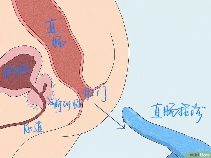 關(guān)于前列腺按摩的正確方法與部位，前列腺按摩的正確方法與部位詳解