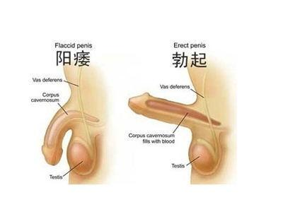 前列腺炎的治療與藥物治療方案，前列腺炎的治療及藥物治療方案詳解