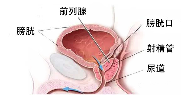 普樂安片治療前列腺炎的療程與效果，深度解析，普樂安片治療前列腺炎療程與效果深度解析，療程長短與治療效果一覽無余。