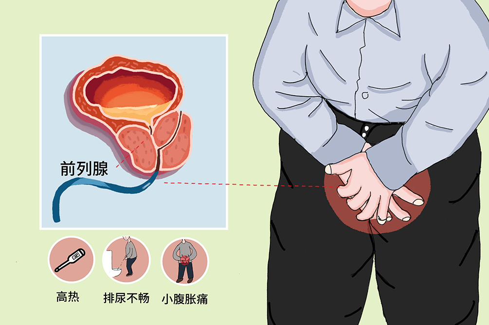 前列腺炎的緩解方法，了解、預(yù)防與改善，前列腺炎緩解方法，了解、預(yù)防與改善措施