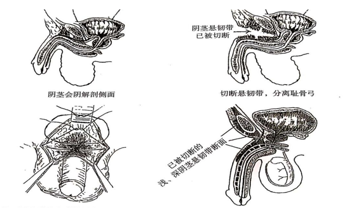 男性增大手術(shù)靠譜嗎？深度解析與探討，男性增大手術(shù)深度解析，可靠性與風(fēng)險(xiǎn)探討